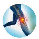 Esguinde de Rodilla, Osteoartrosis 