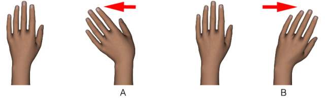 FracturaMuñecaRehabilitacion11