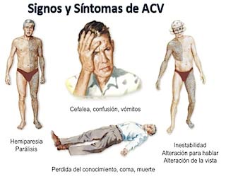 EnfermedadVascularCerebral_EVC_Rehabilitacion_01