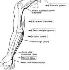 lesionnerviocubital01