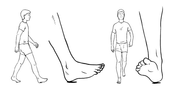 rehabilitacionmarcha02