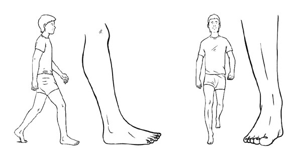 rehabilitacionmarcha03