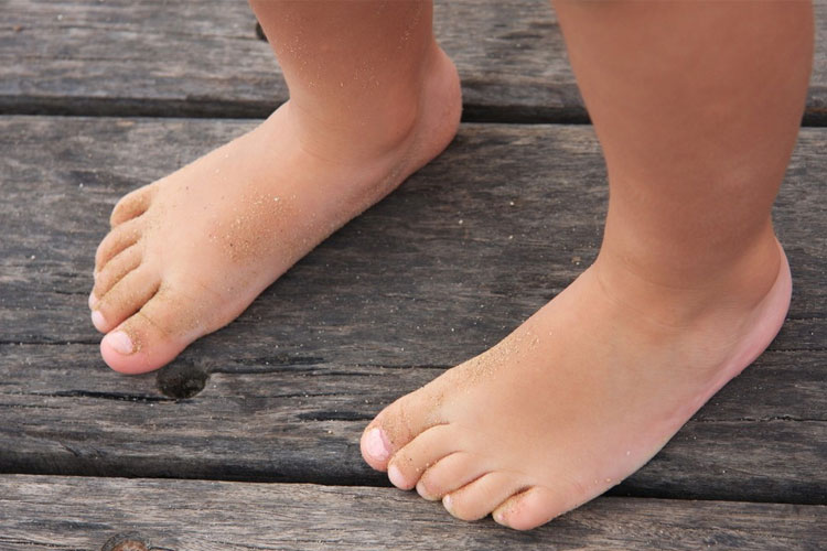 Pie Plano Valgo Infantil, ¿Cómo tratarlo? En GHAAMASHA te ayudamos