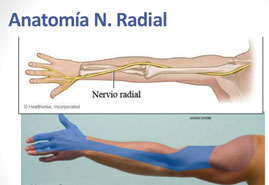 lesionnervioradialninios01